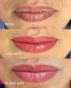 Facetune_06-07-2024-12-19-09