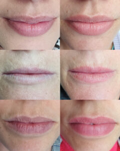 Facetune_18-10-2022-13-47-04