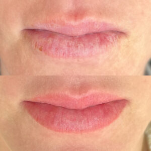 Facetune_22-07-2024-11-09-30