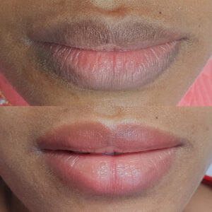 Facetune_29-07-2022-23-23-35