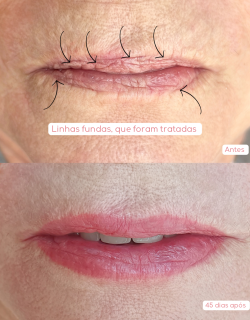 860BD325-A111-4EAD-92B6-D0A53C846F64